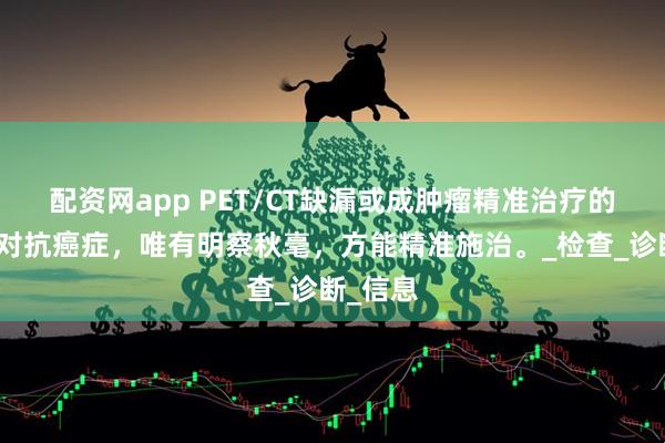 配资网app PET/CT缺漏或成肿瘤精准治疗的阻碍？对抗癌症，唯有明察秋毫，方能精准施治。_检查_诊断_信息